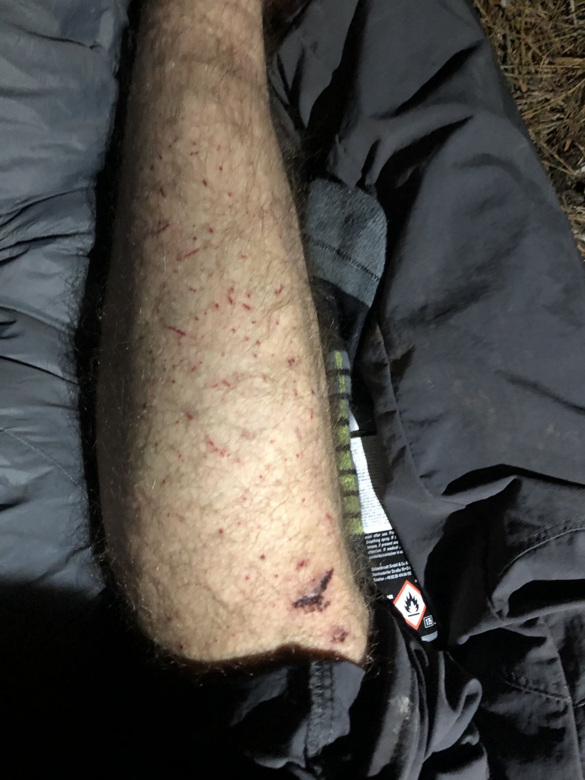 Tetování, které jsem měl skoro všude:)