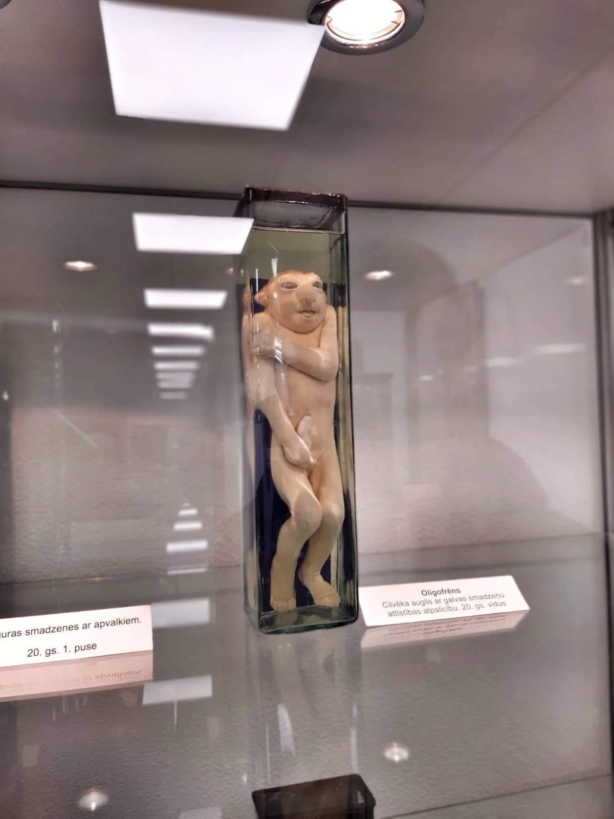 Muzeum historie medicíny