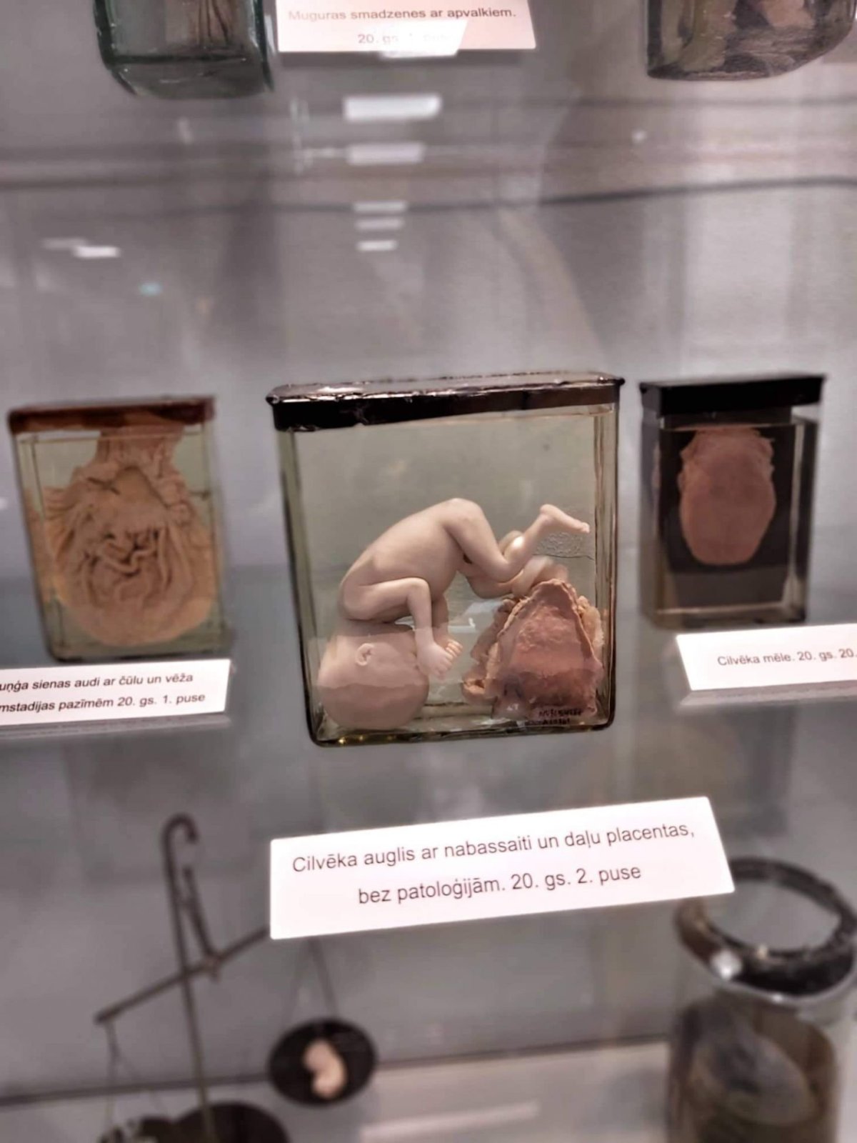 Muzeum historie medicíny