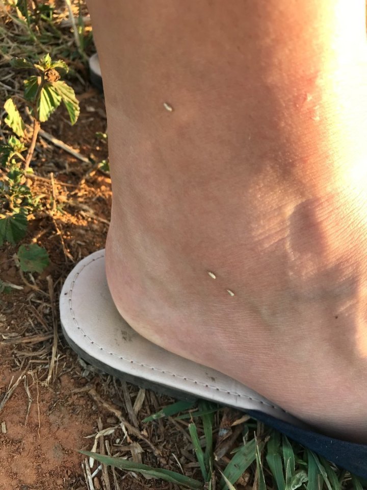 A protože nohou není nikdy dost, přidávám ještě agresivní semínka nějaké hodně naštvané kytky, zabodaná v mém kotníku. Nebylo to